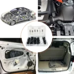 Kit de Clips de Fixation Auto 415+1 Pièces – Universel pour Voiture avec Outil de Dépose Inclus – Image 6
