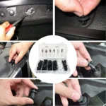 Kit de Clips de Fixation Auto 415+1 Pièces – Universel pour Voiture avec Outil de Dépose Inclus – Image 5